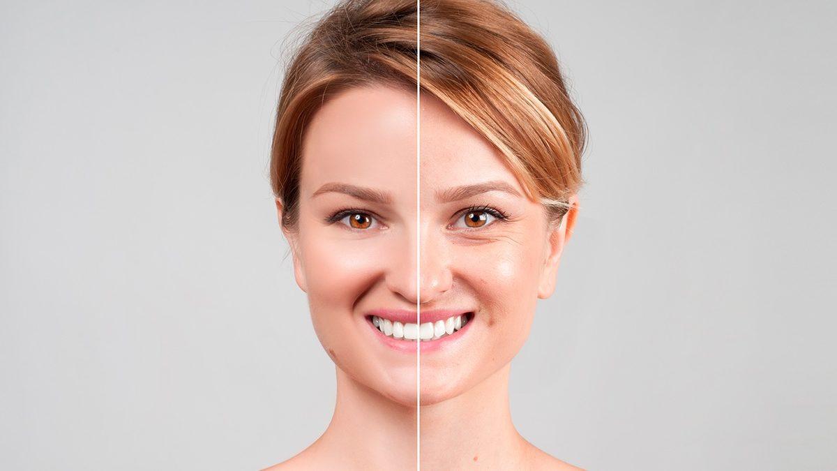 Sadece Saç ve Cildimiz Değil, Vücudumuzun Tamamı İçin Hayati Öneme Sahip ’Kolajen’ Nedir, Ne İşe Yarar?