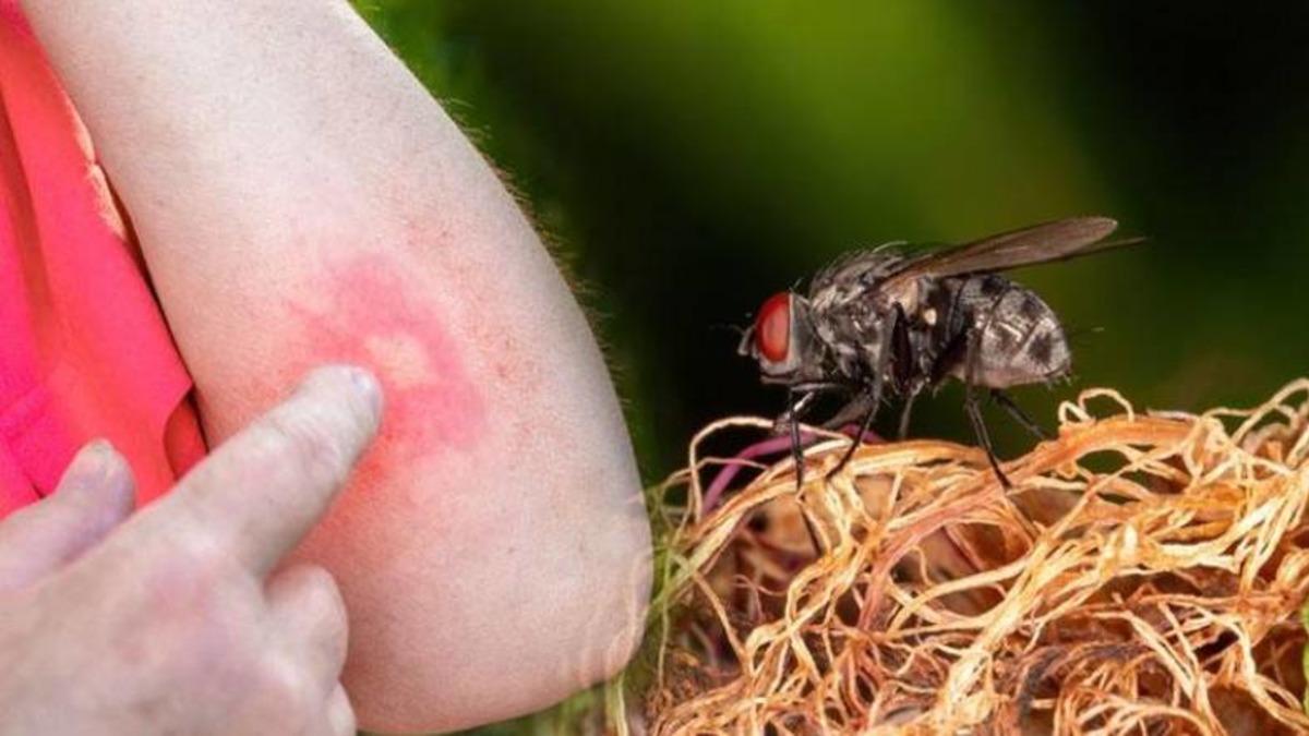 İstanbul’da Şimdi de ’Baldırsokan Sineği’ Paniği Başladı: Halk Sağlığını Tehdit Ediyor