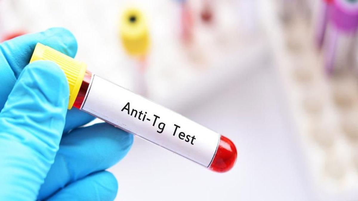 Kan Testlerinde Karşımıza Çıkan ’Anti Tiroglobulin Antikor’ Nedir, Yüksekliği ve Düşüklüğü Ne Anlama Gelir?