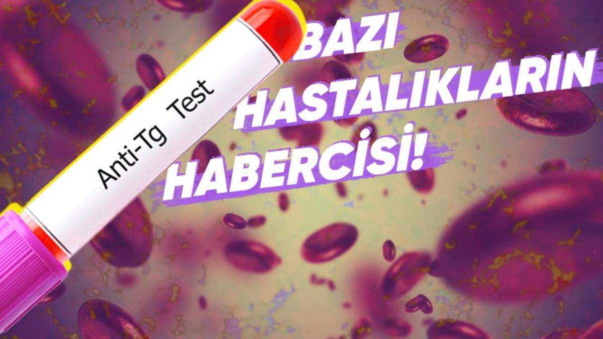 Kan Testlerinde Karşımıza Çıkan ’Anti Tiroglobulin Antikor’ Nedir, Yüksekliği ve Düşüklüğü Ne Anlama Gelir?