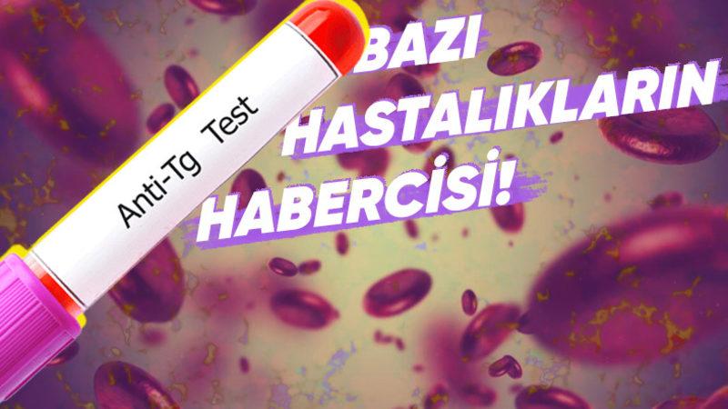 Kan Testlerinde Karşımıza Çıkan ’Anti Tiroglobulin Antikor’ Nedir, Yüksekliği ve Düşüklüğü Ne Anlama Gelir?