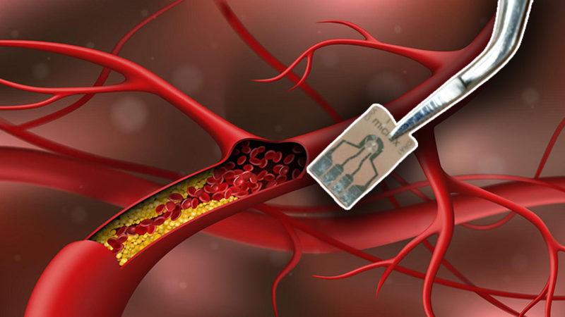 Kolesterolü Normalden Çok Daha Hızlı ve Ucuz Şekilde Ölçebilen Yeni Bir Cihaz İcat Edildi