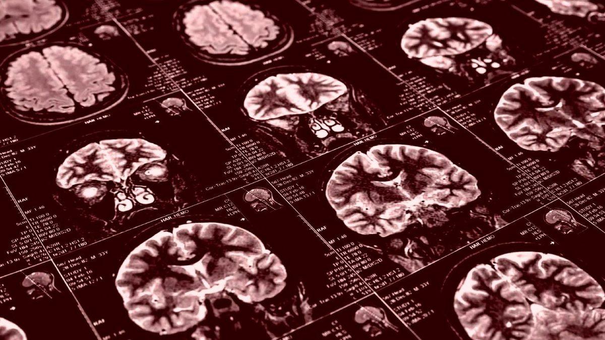 Bilim İnsanları COVID-19’un İnsan Beynine Olan Etkisini Araştırdı: Durum Ciddi