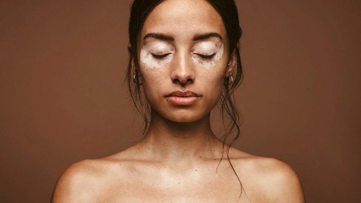 İnsanların Ten Rengi Kumral, Sarışın, Esmer Şeklinde Ayrılmadan Önce Hangi Tek Renge Sahipti?