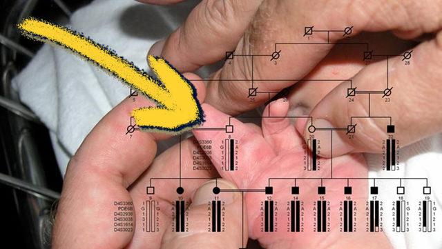 Akraba Evliliği Neden Hastalıklı Çocuklara Neden Olur?