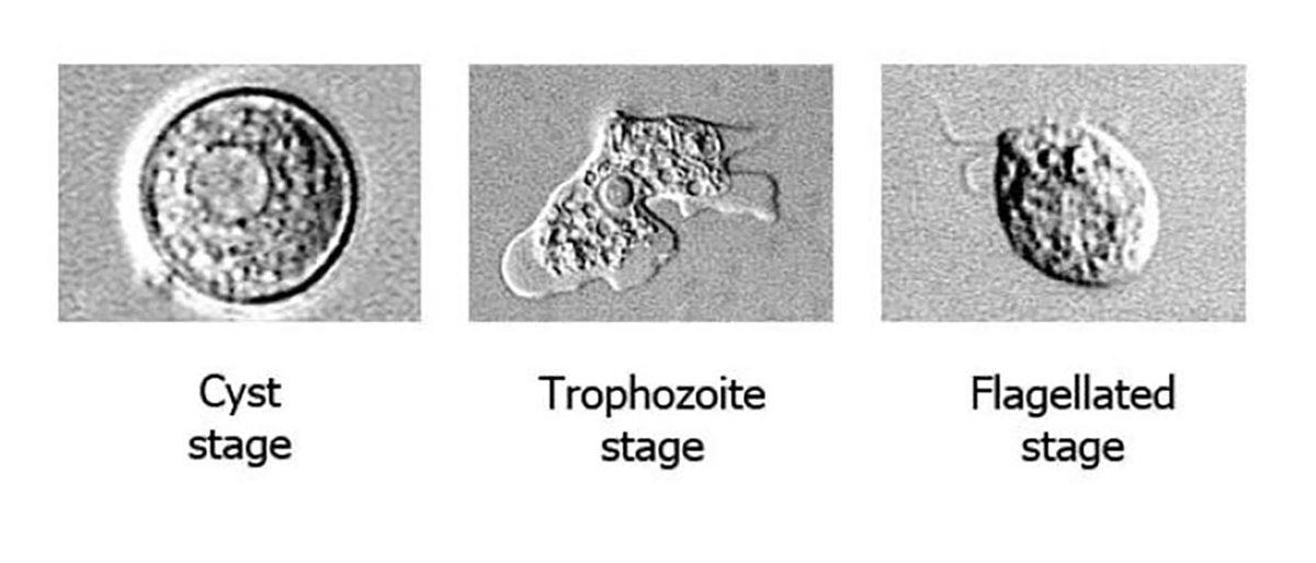 Sürekli Gündeme Gelen ’Beyin Yiyen Amip’ Haberlerine İşin Uzmanından Yanıt: Tehlikede miyiz?