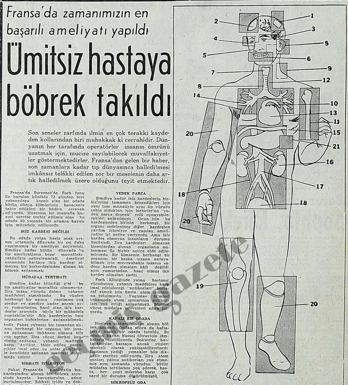 150 Yıl Boyunca Sevişmek mi? Okurken 