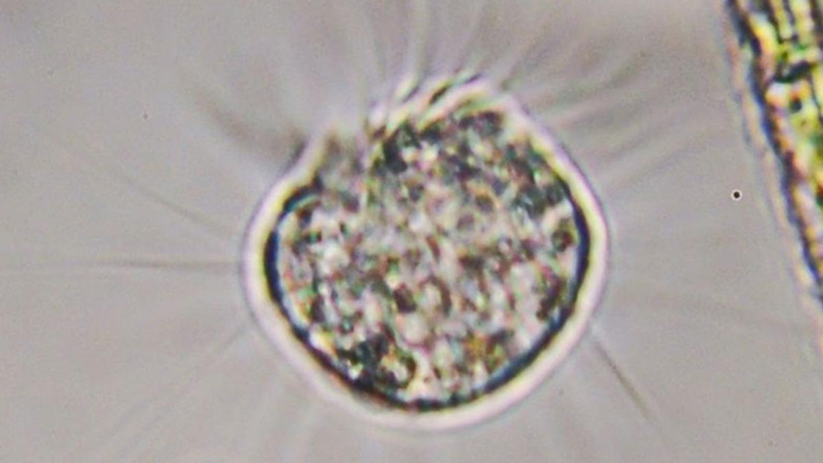 Sadece Virüsleri Yiyerek Beslenen “Virovor” Bir Organizma Keşfedildi