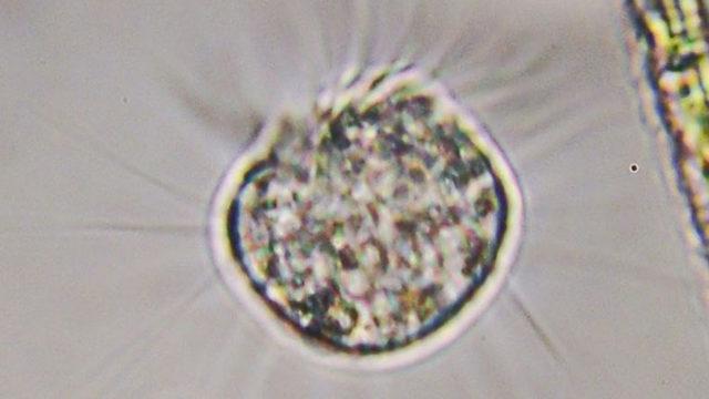 Sadece Virüsleri Yiyerek Beslenen “Virovor” Bir Organizma Keşfedildi