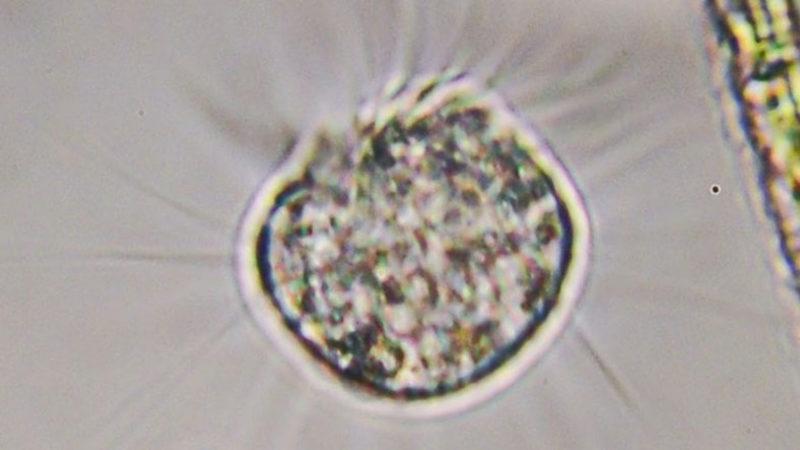 Sadece Virüsleri Yiyerek Beslenen “Virovor” Bir Organizma Keşfedildi