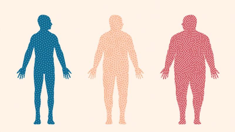 Sonuçlar Korkutucu: Obezitenin COVID-19 Ölüm Oranlarını Ne Kadar Artırdığı Açıklandı