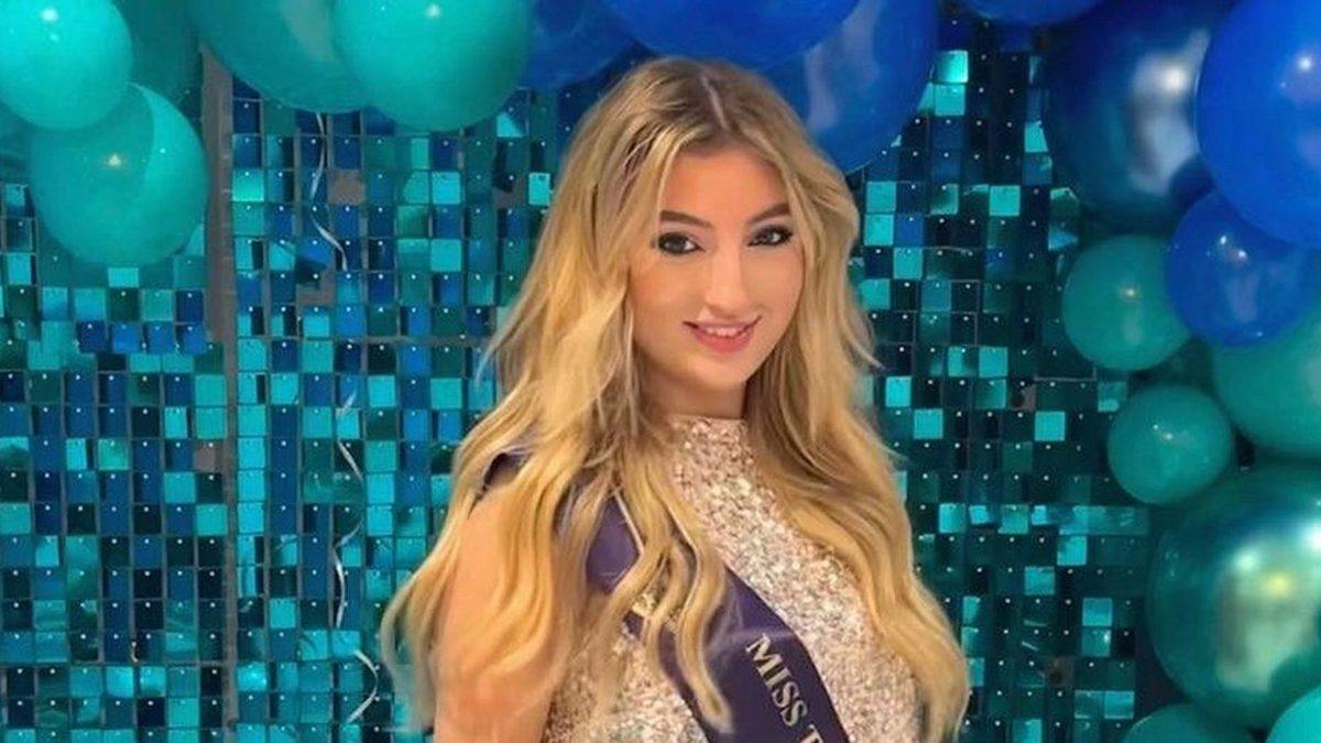 TikTok, Bir Kullanıcısını Sivilcelerini Gösterdiği İçin Banladı: Videolar ’Rahatsız Edici’ İçerik Olarak Damgalandı!