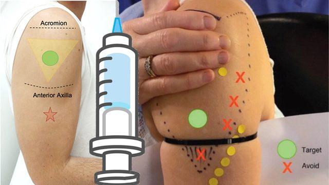 Aşı Neden Genellikle Kalçadan veya Başka Bir Yerden Değil de Omuzdan Yapılır?