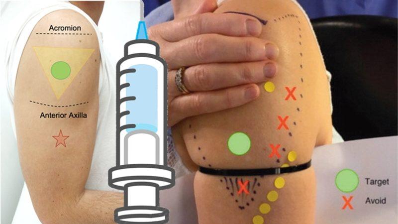 Aşı Neden Genellikle Kalçadan veya Başka Bir Yerden Değil de Omuzdan Yapılır?