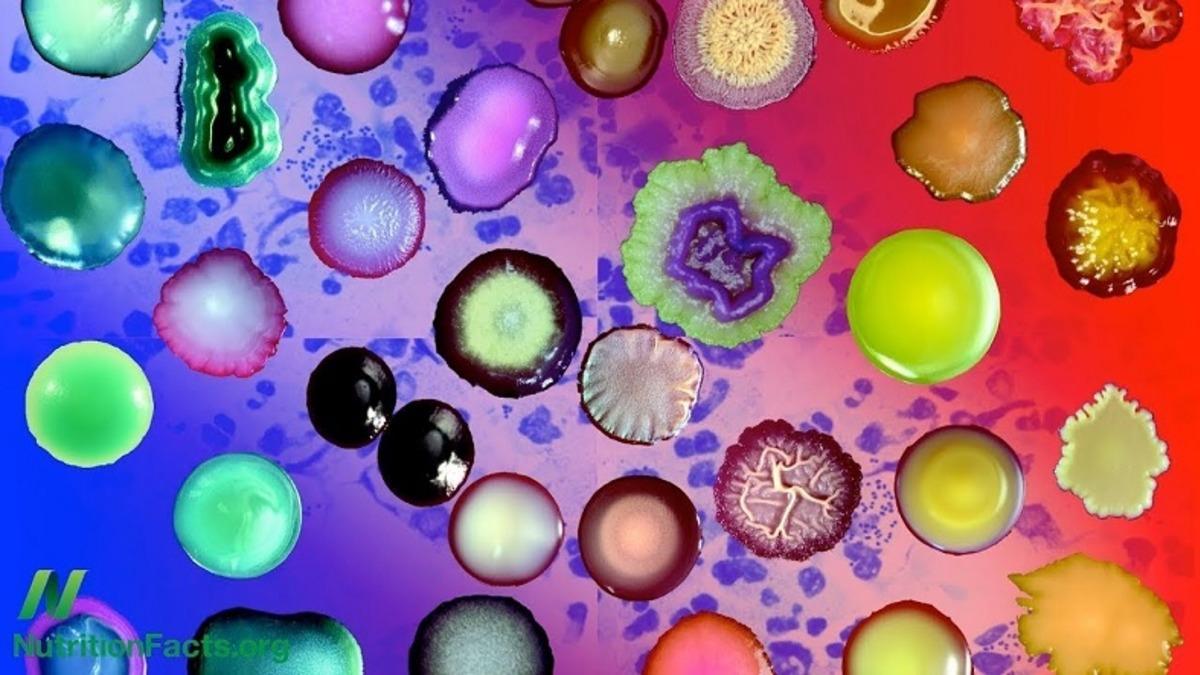 Kan Tahlilinde Gördüğümüz Vücudumuzun Demir Deposu Ferritin Nedir, Yüksekliği ve Düşüklüğü Ne Anlama Gelir?