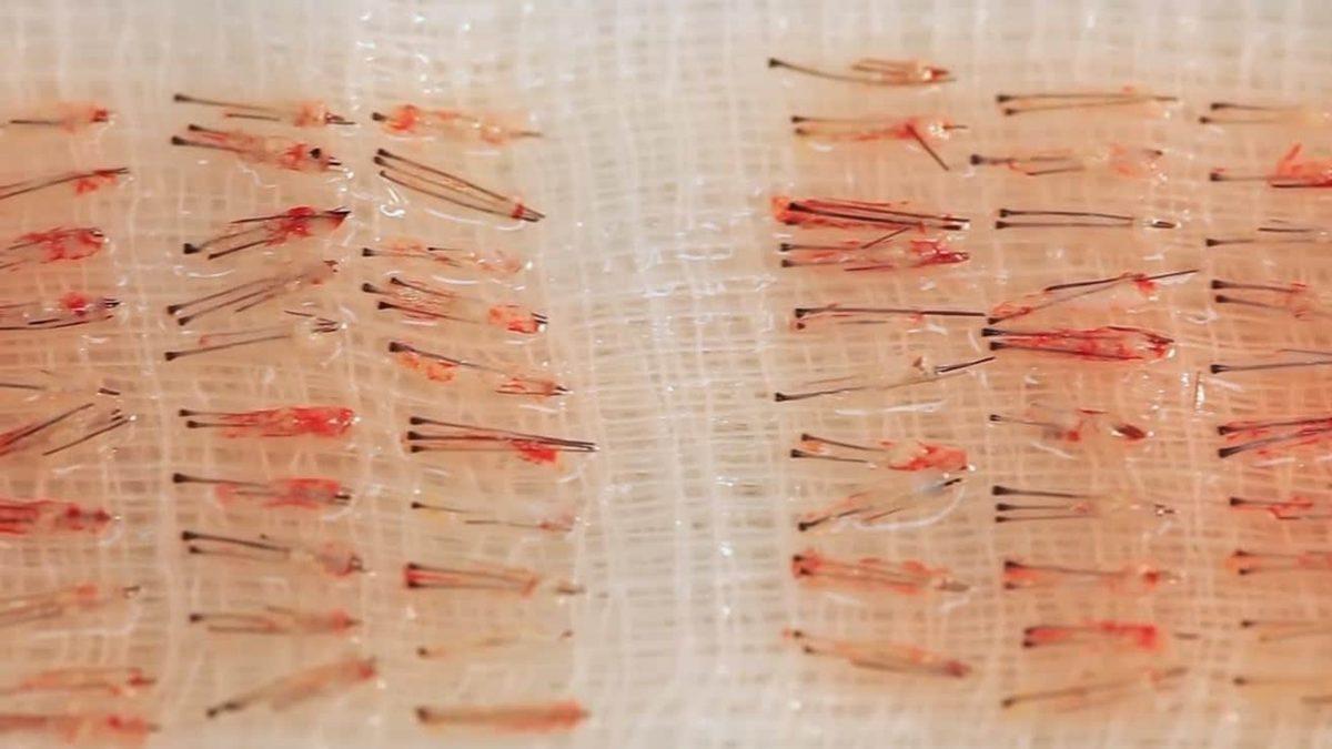 Saç Ekimi Sonrası Cinsel İlişkinin Bir Süreliğine Yasaklanmasının Sebebi Nedir?