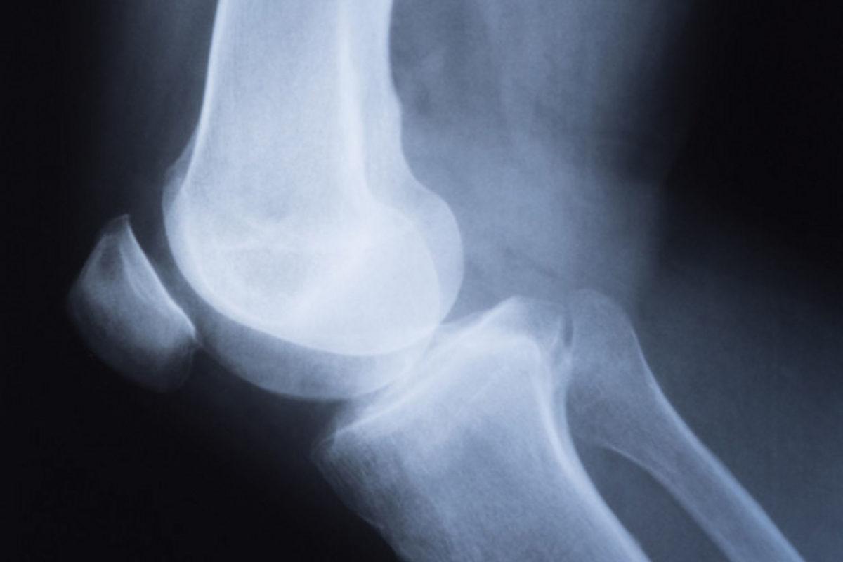 Erkekler Süt Üretiyor mu: İnsan Evrimi Hakkında 10 Büyüleyici Gerçek