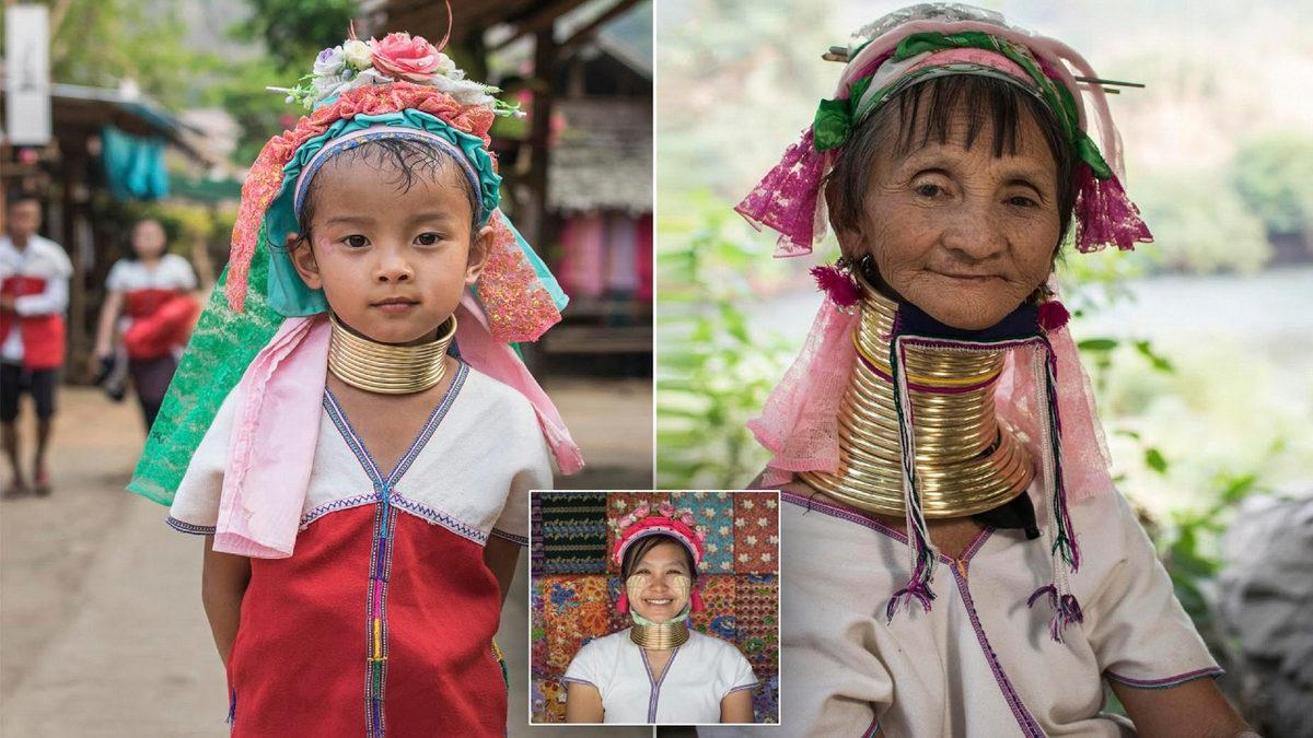 Güzel Olmak İçin mi Çile Çekiyorlar Dersiniz: Asya’nın Zürafa Kadınları