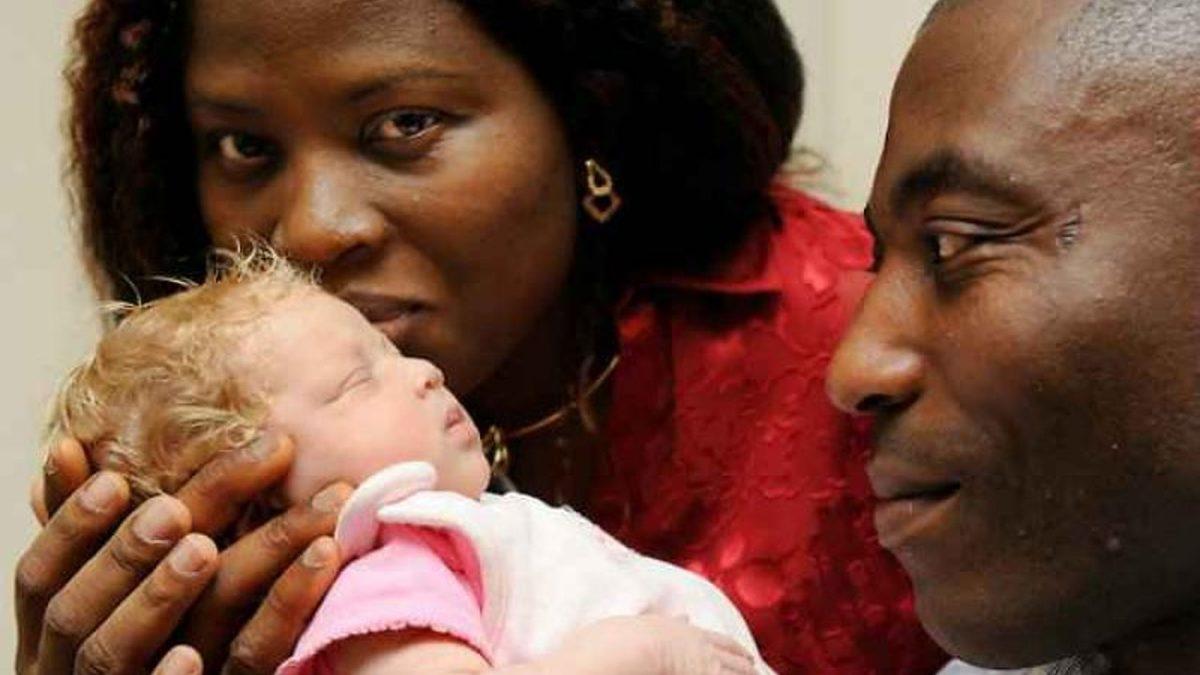 Leylekler Rotayı Karıştırmış: Nasıl Oluyor da Siyahi Ebeveynlerden Sapsarı Saçlı ve Bembeyaz Tenli Bir Bebek Doğabiliyor?