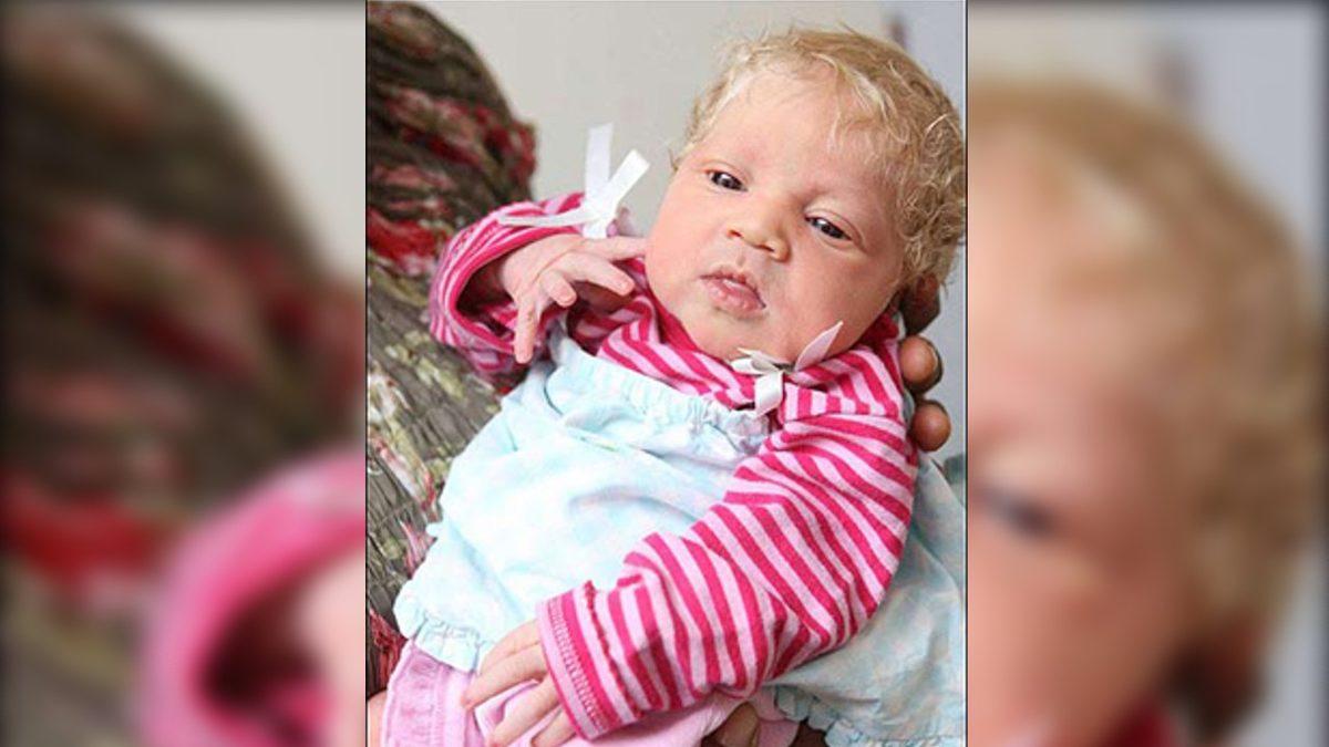 Leylekler Rotayı Karıştırmış: Nasıl Oluyor da Siyahi Ebeveynlerden Sapsarı Saçlı ve Bembeyaz Tenli Bir Bebek Doğabiliyor?