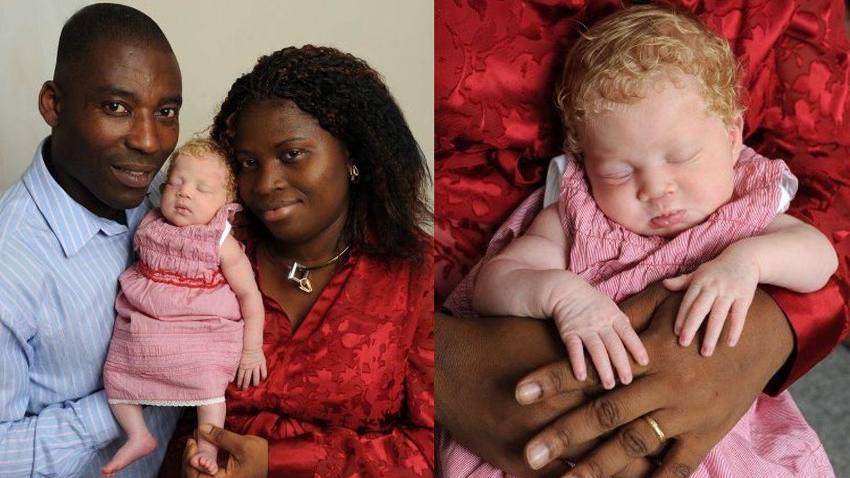 Leylekler Rotayı Karıştırmış: Nasıl Oluyor da Siyahi Ebeveynlerden Sapsarı Saçlı ve Bembeyaz Tenli Bir Bebek Doğabiliyor?