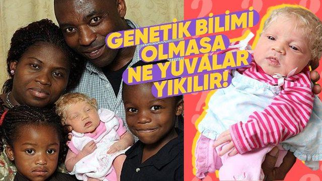 Leylekler Rotayı Karıştırmış: Nasıl Oluyor da Siyahi Ebeveynlerden Sapsarı Saçlı ve Bembeyaz Tenli Bir Bebek Doğabiliyor?