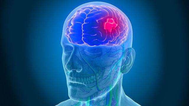 Bilim İnsanları Oksijensiz Kalan Beyin Hücrelerini Hayata Döndürebileceklerini Keşfetti