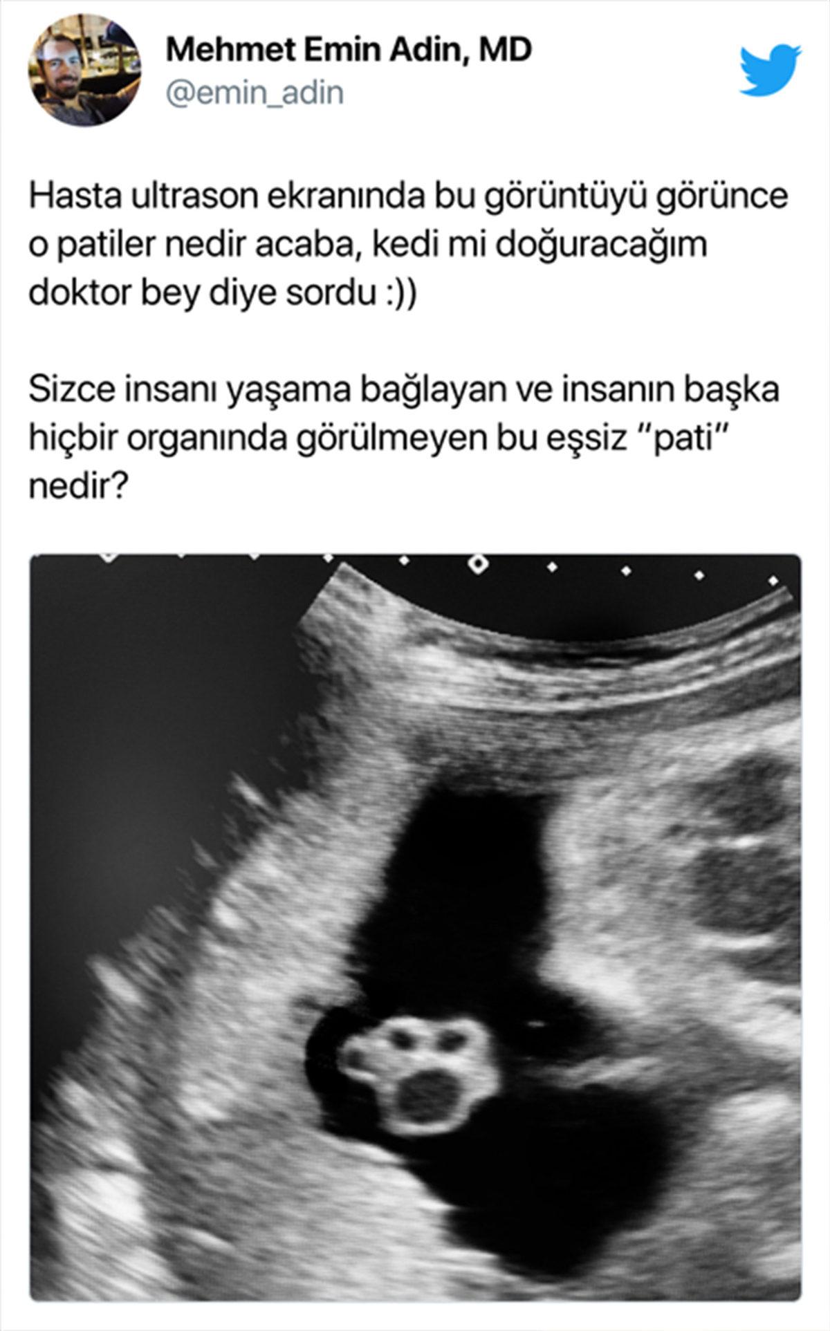 Bi’ Kedi Gördüm Sanki: Hamile Kadınların Ultrason Görüntüsündeki Bu ’Pati’ İzi Aslında Ne?