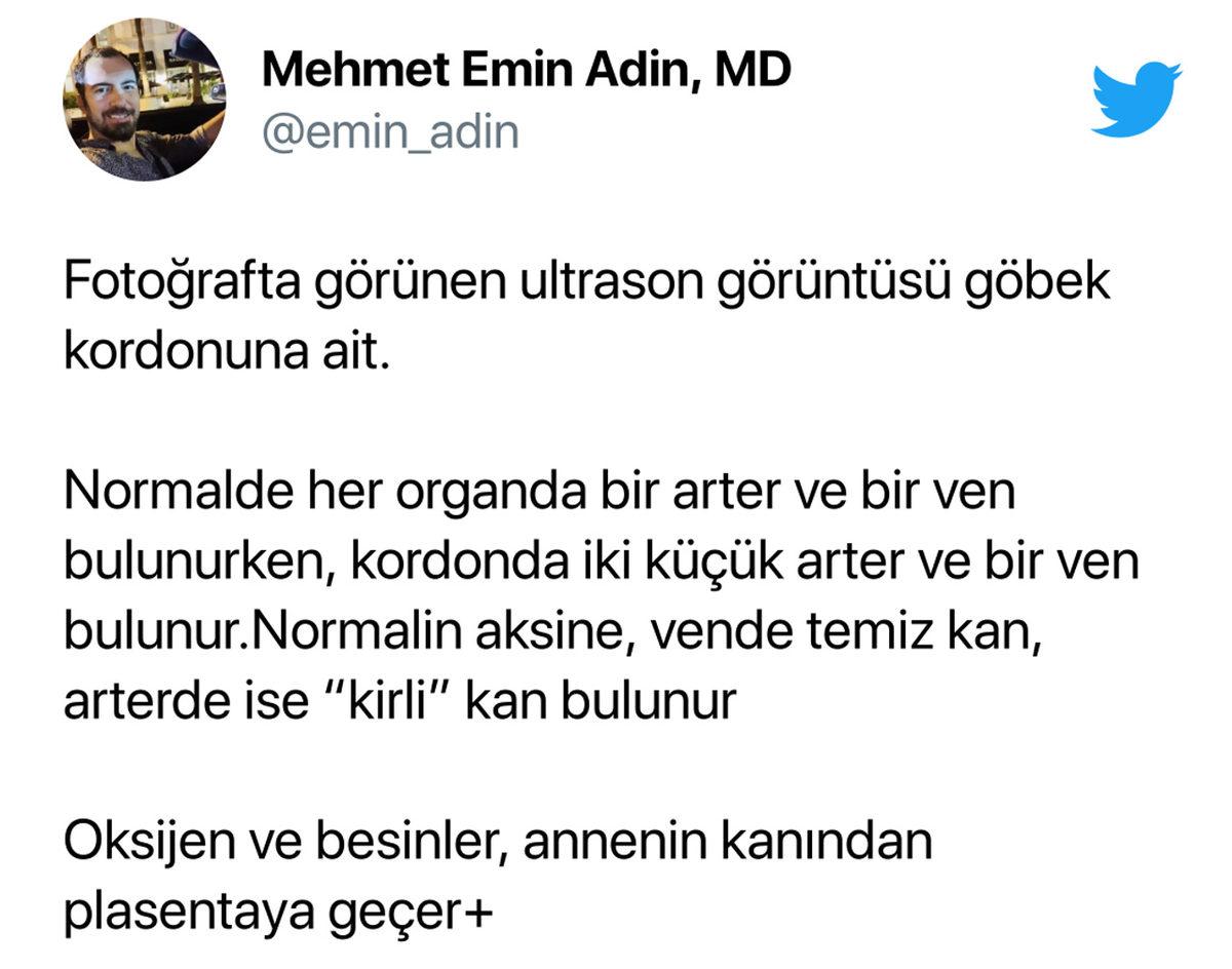 Bi’ Kedi Gördüm Sanki: Hamile Kadınların Ultrason Görüntüsündeki Bu ’Pati’ İzi Aslında Ne?