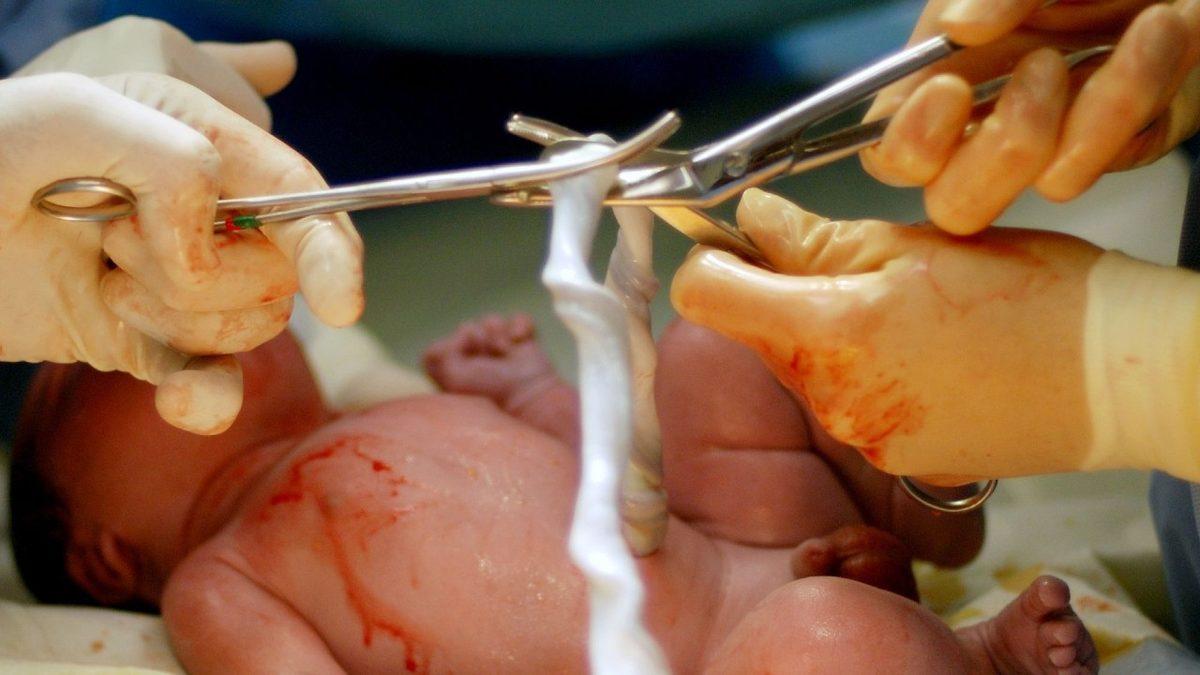 Bi’ Kedi Gördüm Sanki: Hamile Kadınların Ultrason Görüntüsündeki Bu ’Pati’ İzi Aslında Ne?