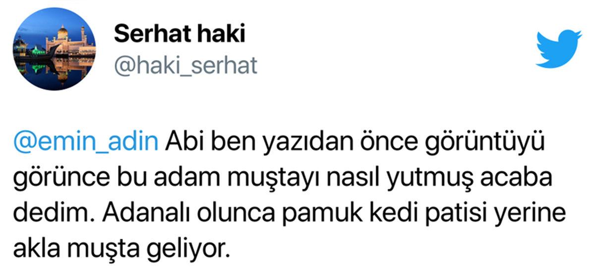Bi’ Kedi Gördüm Sanki: Hamile Kadınların Ultrason Görüntüsündeki Bu ’Pati’ İzi Aslında Ne?