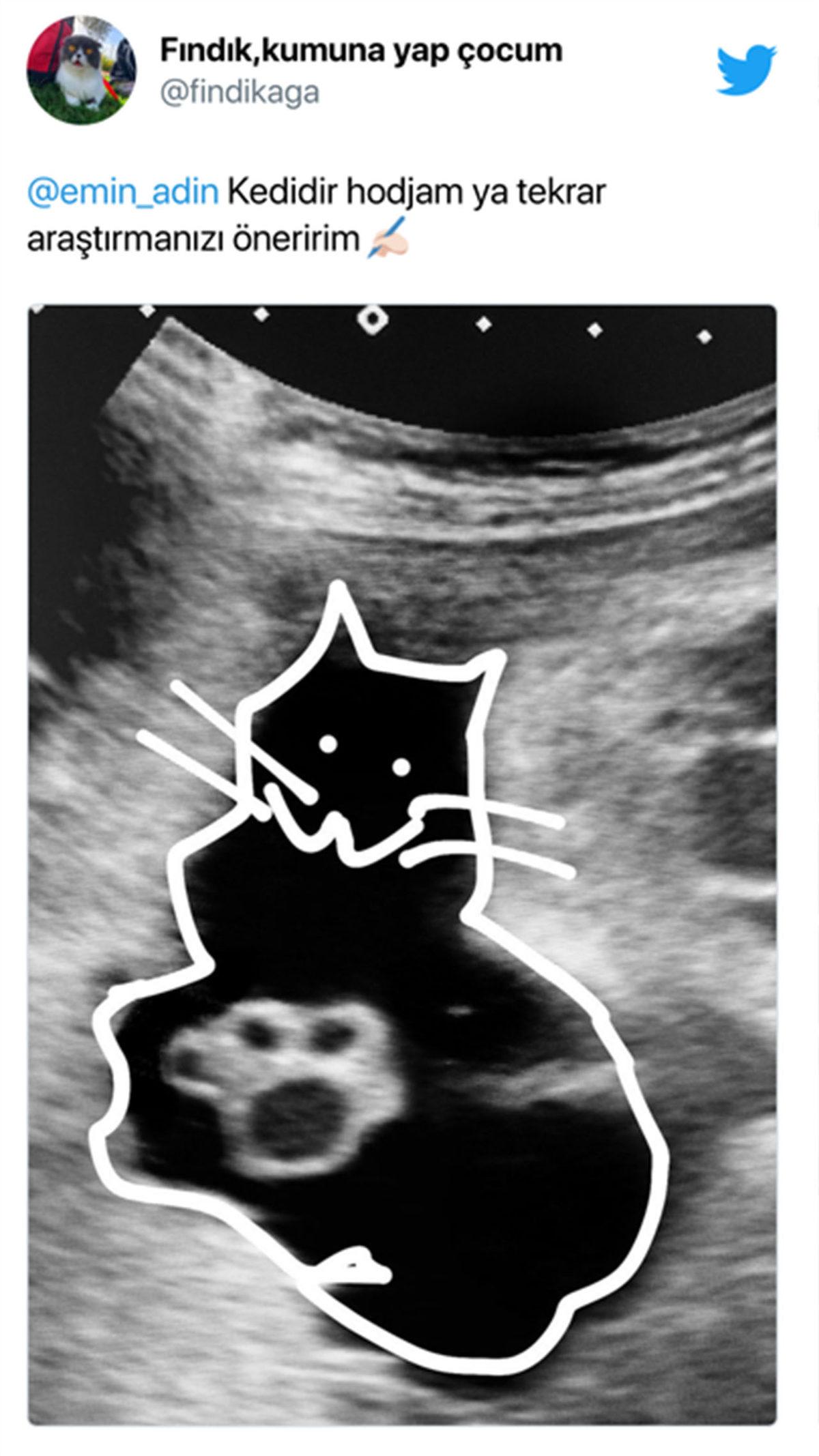 Bi’ Kedi Gördüm Sanki: Hamile Kadınların Ultrason Görüntüsündeki Bu ’Pati’ İzi Aslında Ne?