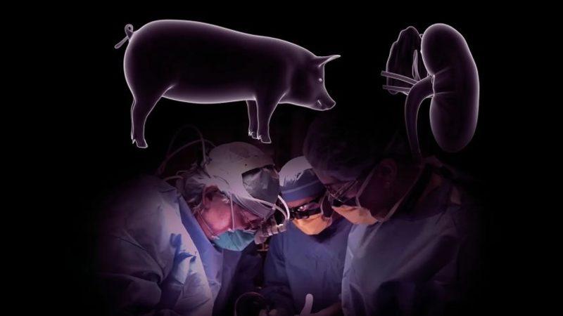 Dünyada İlk Kez Bir Domuz Böbreği, İnsana Nakledildi: Milyonlarca Organ Yetmezliği Hastasına Umut Oldu