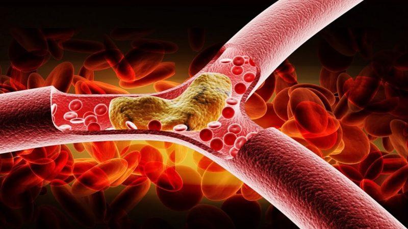 Halk Arasında ’Kötü Kolestrol’ Olarak Bilinen LDL Kolesterol Nedir, Düşüklüğü ve Yüksekliği Ne Anlama Gelir?