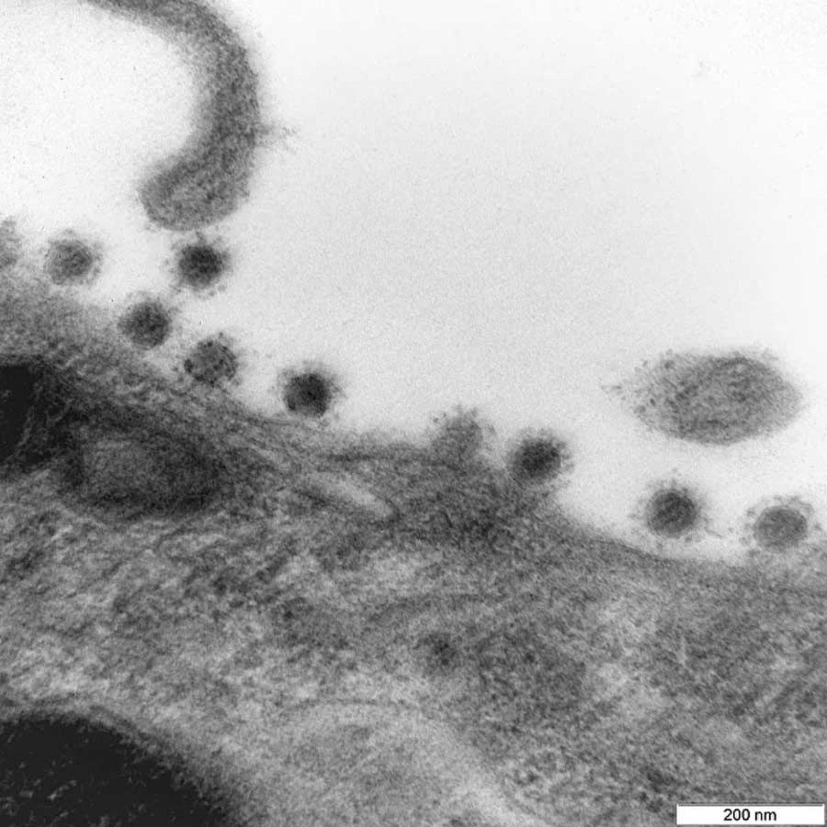 Sal Bizi Artık: Delta Varyantının İlk Kez Fotoğrafı Paylaşıldı