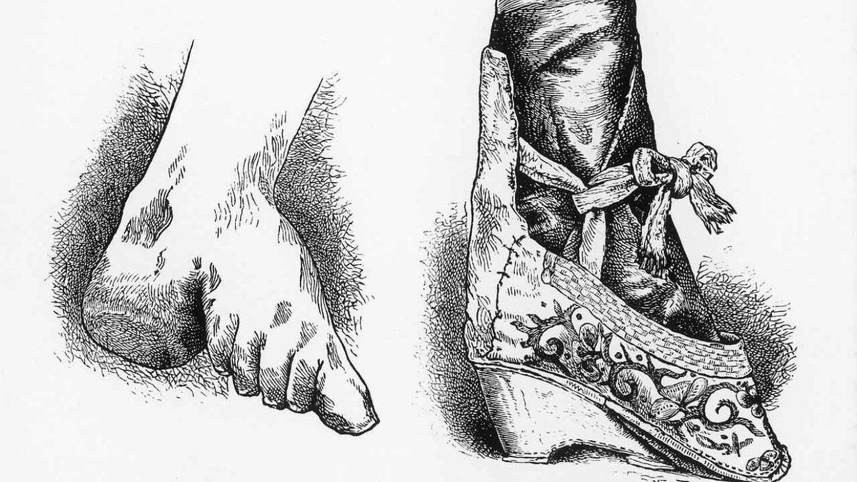 Bir Tür Ayak Fetişi Olarak Görülen ve Pek Çok Rahatsızlığa Yol Açan Bin Yıllık Korkunç Çin Geleneği: Lotus Ayak