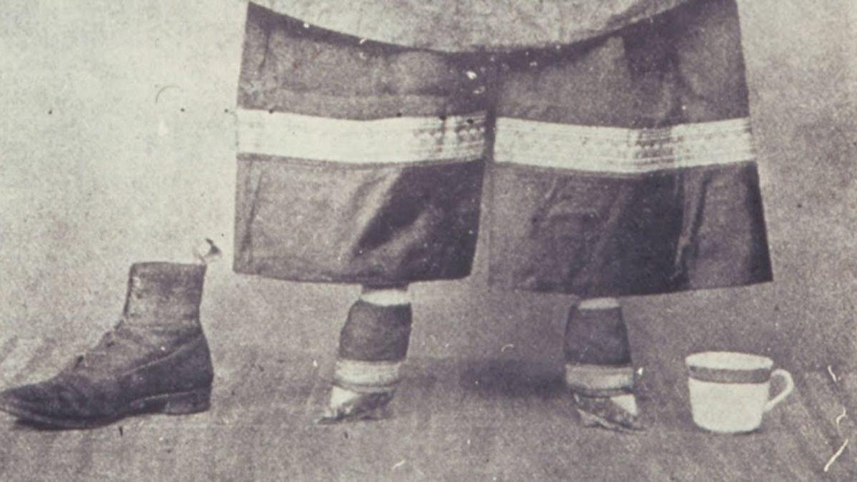 Bir Tür Ayak Fetişi Olarak Görülen ve Pek Çok Rahatsızlığa Yol Açan Bin Yıllık Korkunç Çin Geleneği: Lotus Ayak