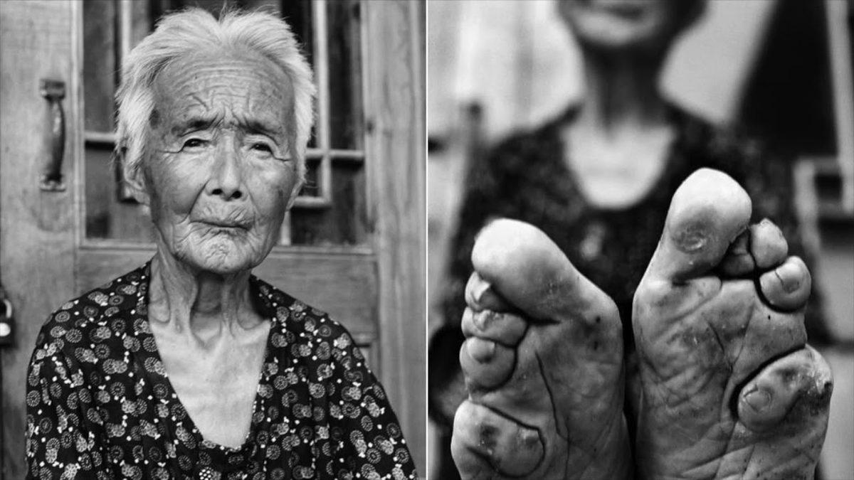 Bir Tür Ayak Fetişi Olarak Görülen ve Pek Çok Rahatsızlığa Yol Açan Bin Yıllık Korkunç Çin Geleneği: Lotus Ayak