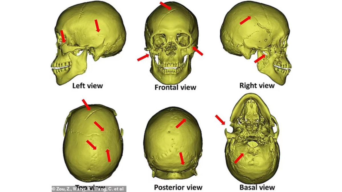 Bilinen En Eski Faili Meçhul Cinayet, 1300 Yıl Sonra Aydınlatıldı