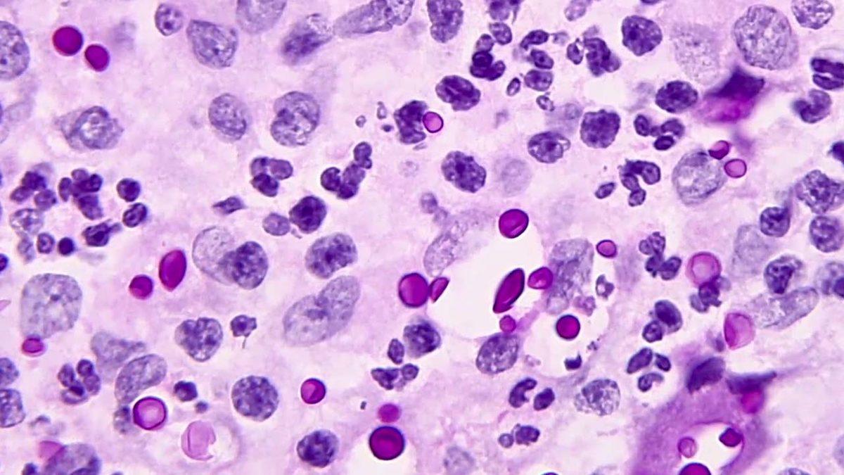 Havalar Soğumazsa The Last of Us Gerçek Olabilir: İşte Yeni Araştırmanın Ortaya Koyduğu Sonuçlar