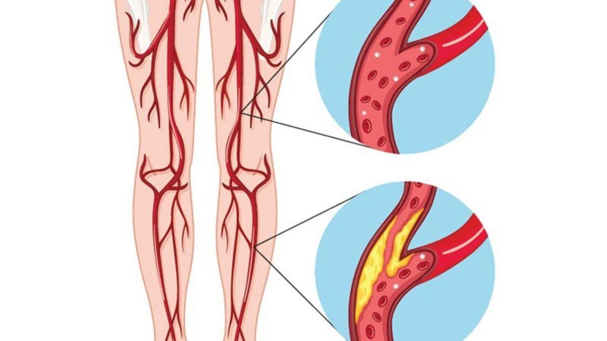Ayaklarımız Vücudumuzdaki Diğer Bölgelere Göre Neden Daha Fazla Üşür?