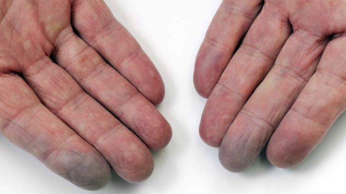 Ayaklarımız Vücudumuzdaki Diğer Bölgelere Göre Neden Daha Fazla Üşür?