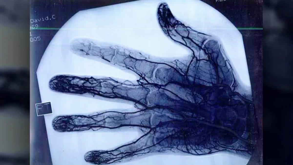 Ayaklarımız Vücudumuzdaki Diğer Bölgelere Göre Neden Daha Fazla Üşür?