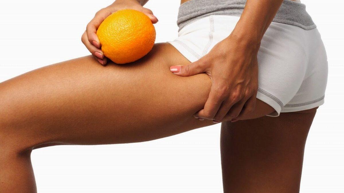 Hanımların Dikkatine: Selülit Neden Olur, Gidermek İçin Ne Yapmak Gerekir?