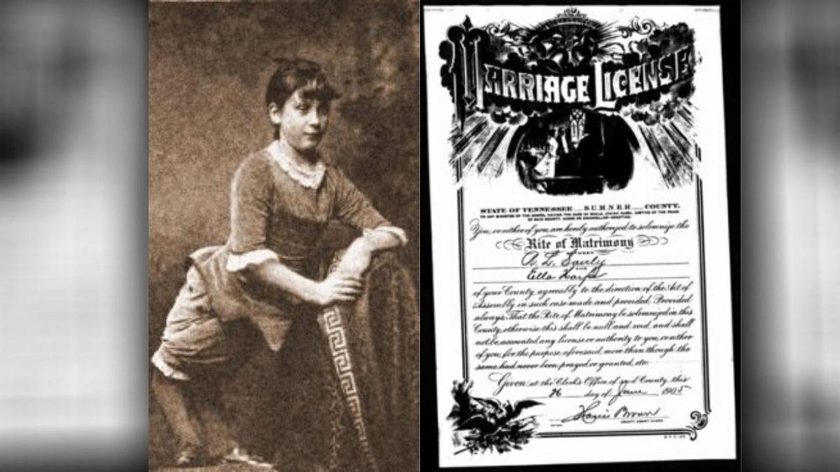 Ayakları Ters Olarak Doğan ve 