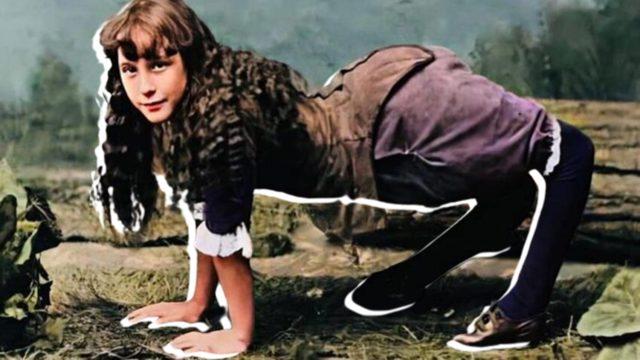 Ayakları Ters Olarak Doğan ve "Deve Kız" Olarak Anılan Ella Harper’ın Çarpıcı Yaşam Öyküsü