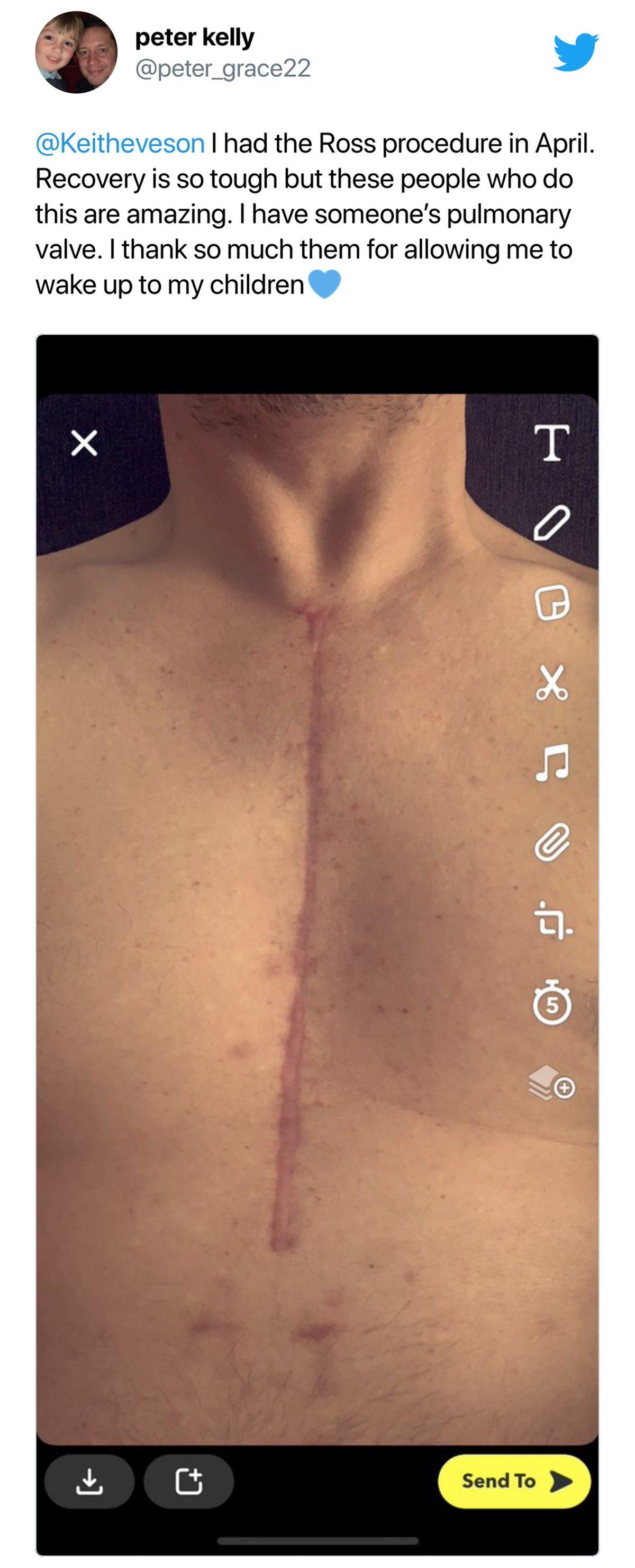 Kalp Nakliyle Son Anda Hayata Dönen Bir Kadının Görünce Yüreğinize Su Serpecek Fotoğrafı