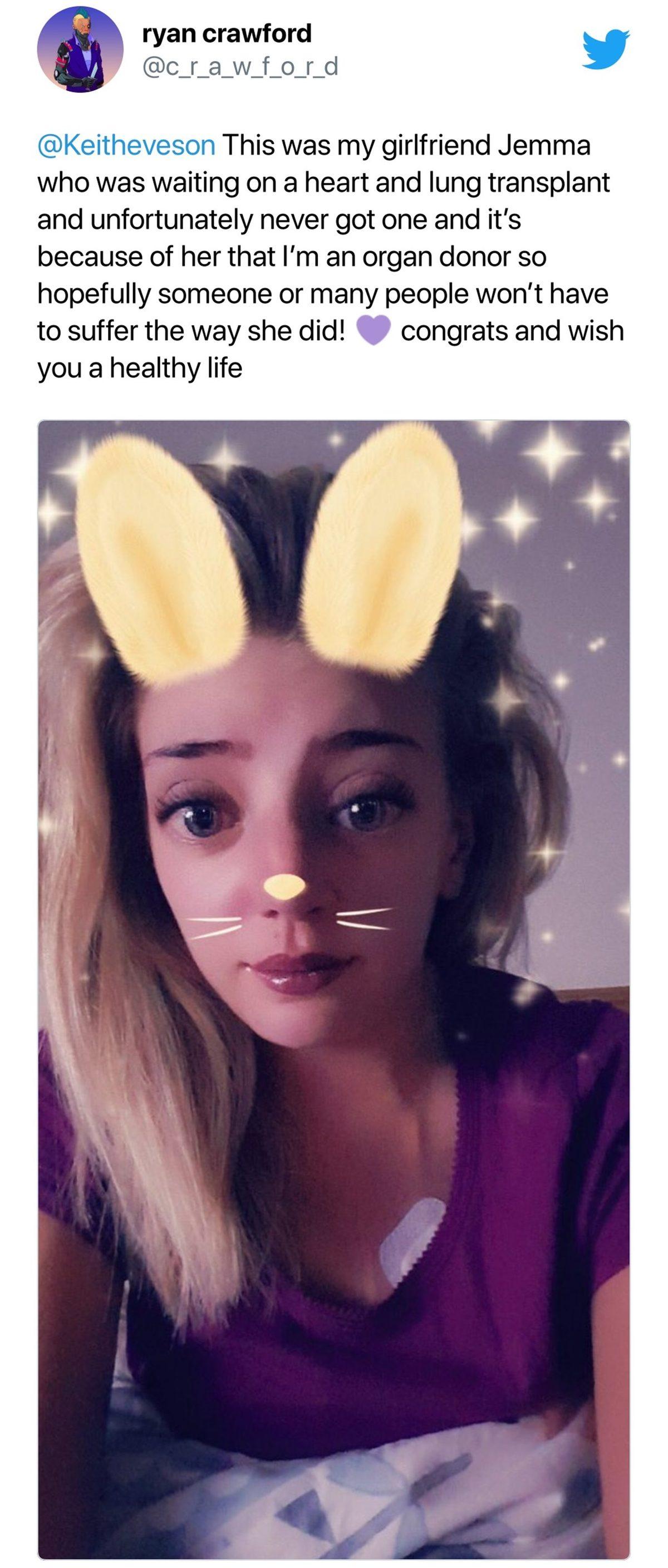 Kalp Nakliyle Son Anda Hayata Dönen Bir Kadının Görünce Yüreğinize Su Serpecek Fotoğrafı