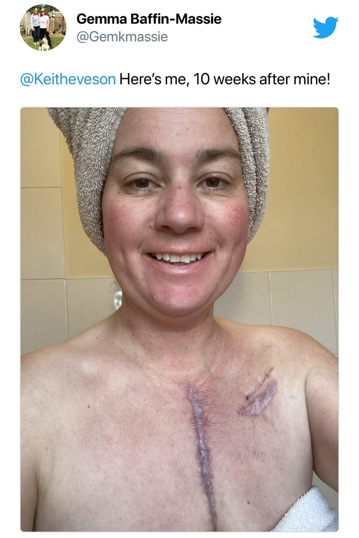 Kalp Nakliyle Son Anda Hayata Dönen Bir Kadının Görünce Yüreğinize Su Serpecek Fotoğrafı