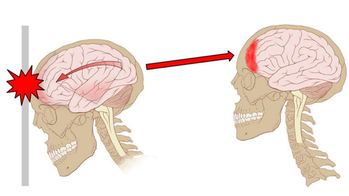 Travmatik Görüntülere Maruz Kaldığımızda Ortaya Çıkabilen 